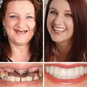 Agrapaws Premium Denture