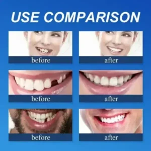 Custom-Fit Full Denture 2026 | Strong Suction Moldable Denture Set